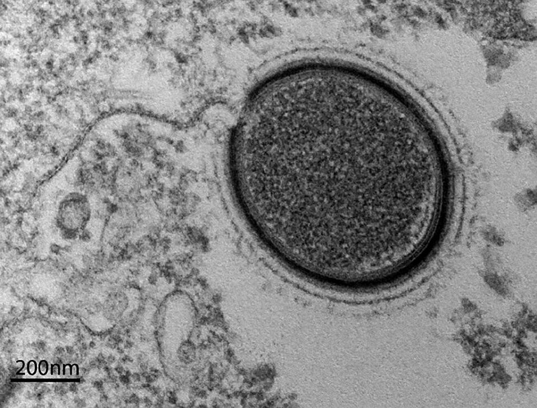 北极发现5.7万年前尸体，科学家担心有更危险东西，人类要警惕